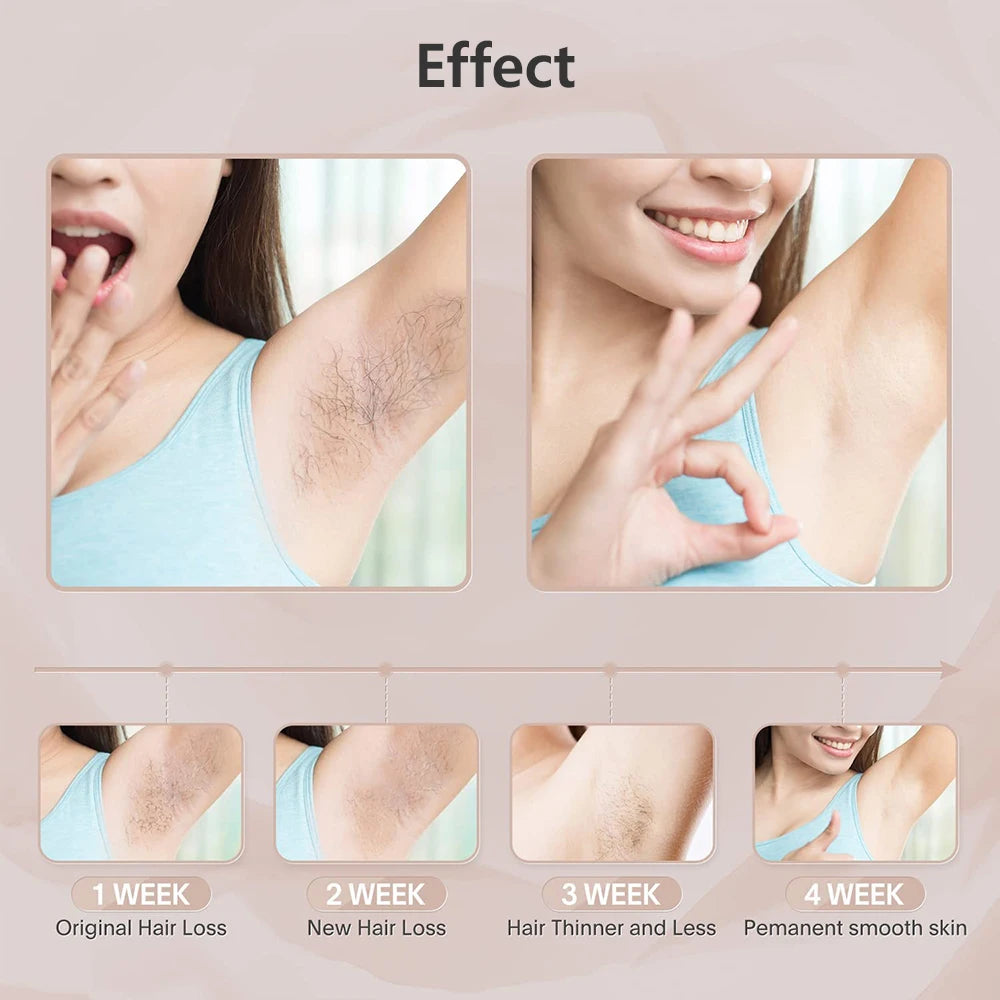 Permanent Laser Epilator 999999 Flashes Professional Painless Laser Hair Removal Machine for Women Body Facial Legs Bikini Line