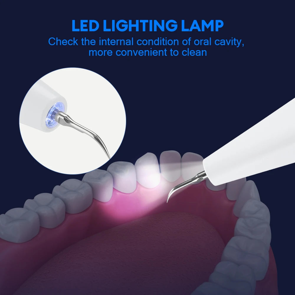 Dental Scaler For Teeth Tartar Remover Electric Teeth Cleaner Tooth Calculus Plaque Remover Ultrasonic Dental Stone Removal